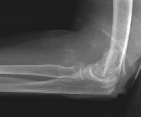 Trauma 2026 MCQs: Board Review Questions & Answers (Part 1) - Figure 145