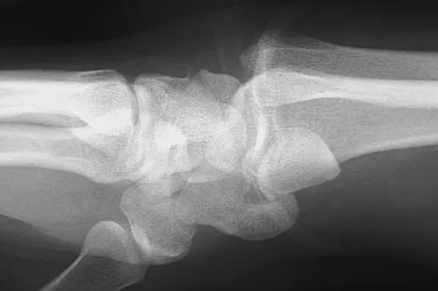 Trauma 2026 MCQs: Board Review Questions & Answers (Part 1) - Figure 149