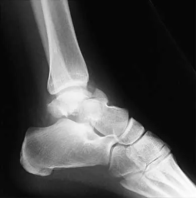 Trauma 2026 MCQs: Board Review Questions & Answers (Part 1) - Figure 21