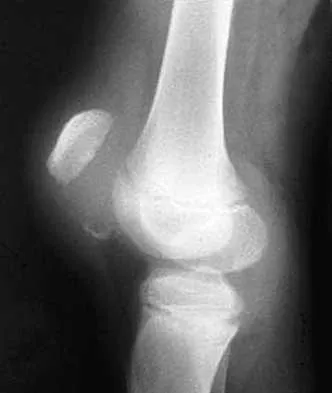 Trauma 2026 MCQs: Board Review Questions & Answers (Part 1) - Figure 29