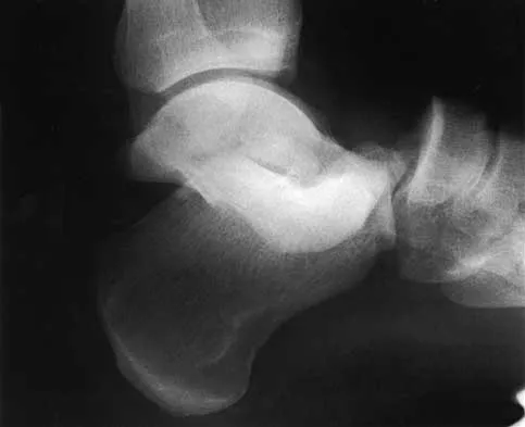 Trauma 2026 MCQs: Board Review Questions & Answers (Part 1) - Figure 3