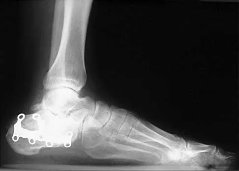 Trauma 2026 MCQs: Board Review Questions & Answers (Part 1) - Figure 31