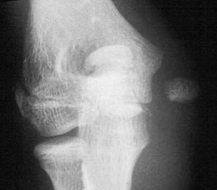 Trauma 2026 MCQs: Board Review Questions & Answers (Part 1) - Figure 33