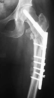 Trauma 2026 MCQs: Board Review Questions & Answers (Part 1) - Figure 41