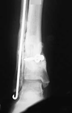 Trauma 2026 MCQs: Board Review Questions & Answers (Part 1) - Figure 51