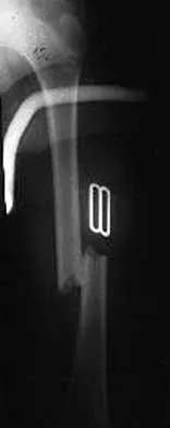 Trauma 2026 MCQs: Board Review Questions & Answers (Part 1) - Figure 57