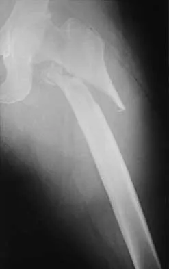 Trauma 2026 MCQs: Board Review Questions & Answers (Part 1) - Figure 61