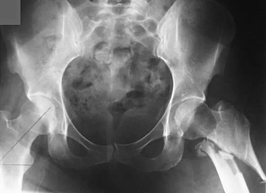 Trauma 2026 MCQs: Board Review Questions & Answers (Part 1) - Figure 63