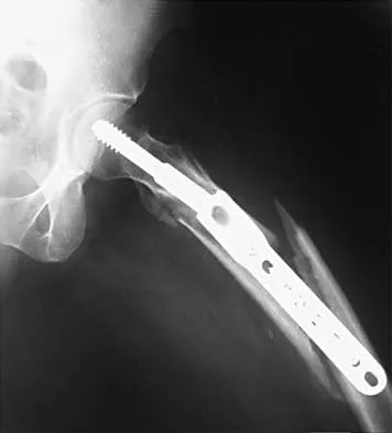 Trauma 2026 MCQs: Board Review Questions & Answers (Part 1) - Figure 69