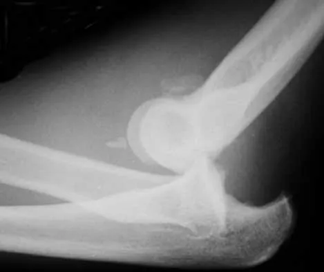 Trauma 2026 MCQs: Board Review Questions & Answers (Part 2) - Figure 111