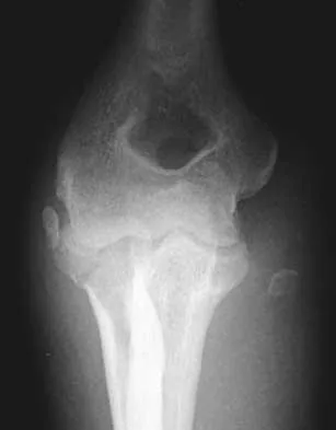 Trauma 2026 MCQs: Board Review Questions & Answers (Part 2) - Figure 113