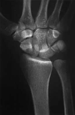 Trauma 2026 MCQs: Board Review Questions & Answers (Part 2) - Figure 125