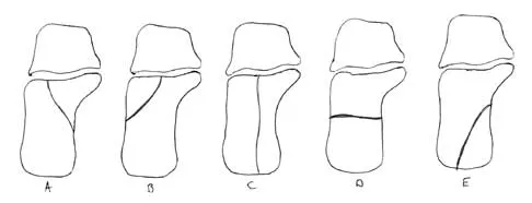 Trauma 2026 MCQs: Board Review Questions & Answers (Part 2) - Figure 13