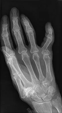 Trauma 2026 MCQs: Board Review Questions & Answers (Part 2) - Figure 153