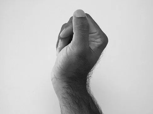 Trauma 2026 MCQs: Board Review Questions & Answers (Part 2) - Figure 157