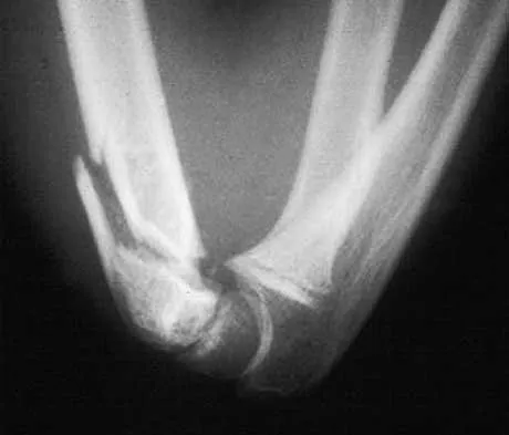 Trauma 2026 MCQs: Board Review Questions & Answers (Part 2) - Figure 3