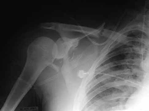 Trauma 2026 MCQs: Board Review Questions & Answers (Part 2) - Figure 37