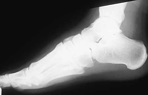 Trauma 2026 MCQs: Board Review Questions & Answers (Part 2) - Figure 41