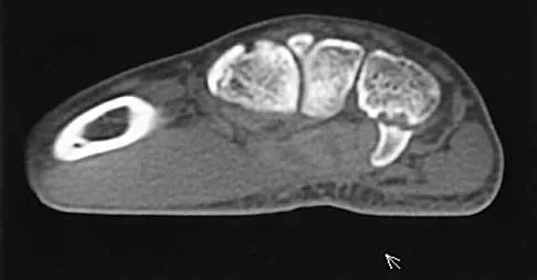 Trauma 2026 MCQs: Board Review Questions & Answers (Part 2) - Figure 55