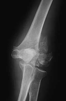 Trauma 2026 MCQs: Board Review Questions & Answers (Part 2) - Figure 73