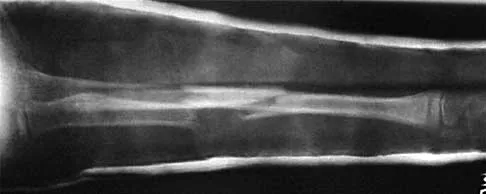 Trauma 2026 MCQs: Board Review Questions & Answers (Part 2) - Figure 97