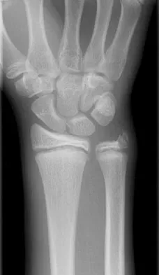 Trauma 2026 MCQs: Board Review Questions & Answers (Part 3) - Figure 103