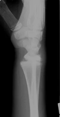 Trauma 2026 MCQs: Board Review Questions & Answers (Part 3) - Figure 105