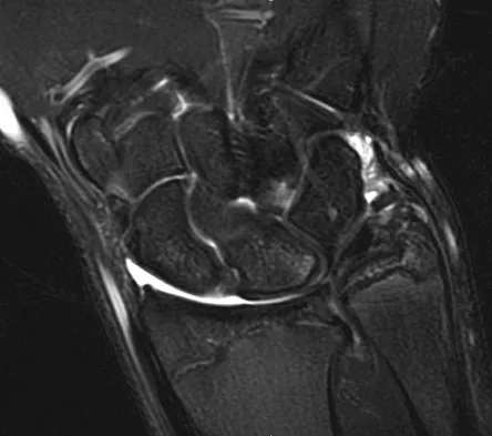 Trauma 2026 MCQs: Board Review Questions & Answers (Part 3) - Figure 109