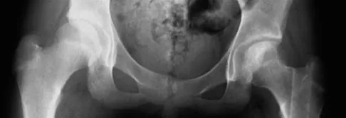 Trauma 2026 MCQs: Board Review Questions & Answers (Part 3) - Figure 113