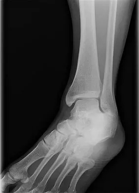 Trauma 2026 MCQs: Board Review Questions & Answers (Part 3) - Figure 119