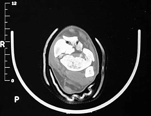 Trauma 2026 MCQs: Board Review Questions & Answers (Part 3) - Figure 15