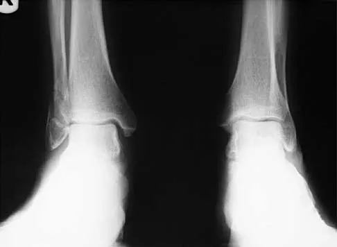 Trauma 2026 MCQs: Board Review Questions & Answers (Part 3) - Figure 17