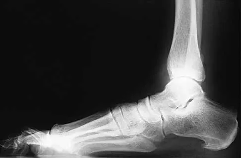 Trauma 2026 MCQs: Board Review Questions & Answers (Part 3) - Figure 21