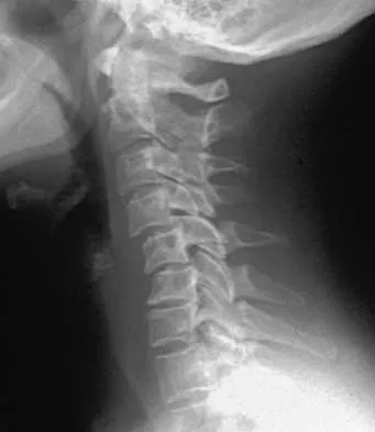 Trauma 2026 MCQs: Board Review Questions & Answers (Part 3) - Figure 27