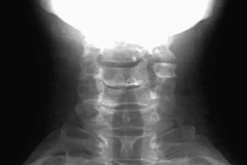 Trauma 2026 MCQs: Board Review Questions & Answers (Part 3) - Figure 29