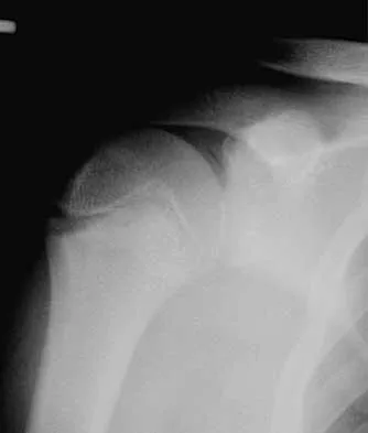 Trauma 2026 MCQs: Board Review Questions & Answers (Part 3) - Figure 33