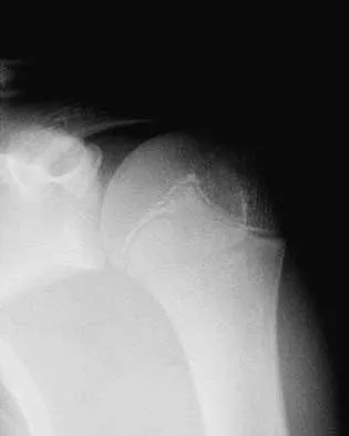 Trauma 2026 MCQs: Board Review Questions & Answers (Part 3) - Figure 35