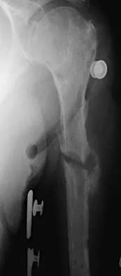 Trauma 2026 MCQs: Board Review Questions & Answers (Part 3) - Figure 41