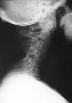 Trauma 2026 MCQs: Board Review Questions & Answers (Part 3) - Figure 47