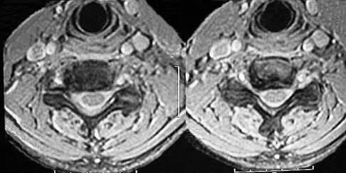 Trauma 2026 MCQs: Board Review Questions & Answers (Part 3) - Figure 51