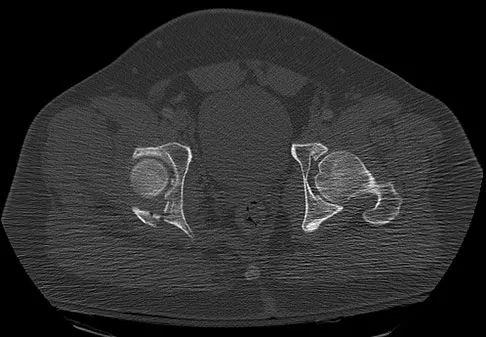 Trauma 2026 MCQs: Board Review Questions & Answers (Part 3) - Figure 53