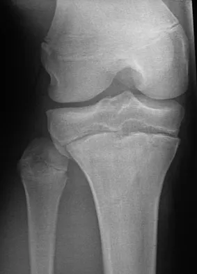 Trauma 2026 MCQs: Board Review Questions & Answers (Part 3) - Figure 61
