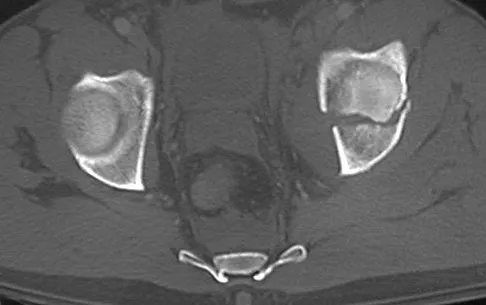 Trauma 2026 MCQs: Board Review Questions & Answers (Part 3) - Figure 87