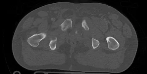 Trauma 2026 MCQs: Board Review Questions & Answers (Part 3) - Figure 99