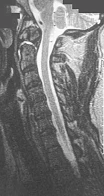 Trauma 2026 MCQs: Board Review Questions & Answers (Part 4) - Figure 13