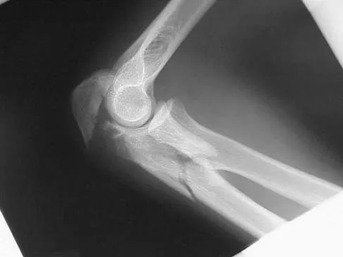 Trauma 2026 MCQs: Board Review Questions & Answers (Part 4) - Figure 43