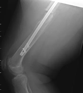 Trauma 2026 MCQs: Board Review Questions & Answers (Part 4) - Figure 49