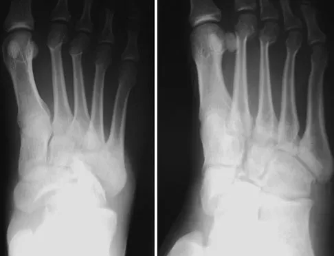 Trauma 2026 MCQs: Board Review Questions & Answers (Part 4) - Figure 51