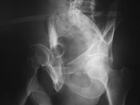 Trauma 2026 MCQs: Board Review Questions & Answers (Part 4) - Figure 55