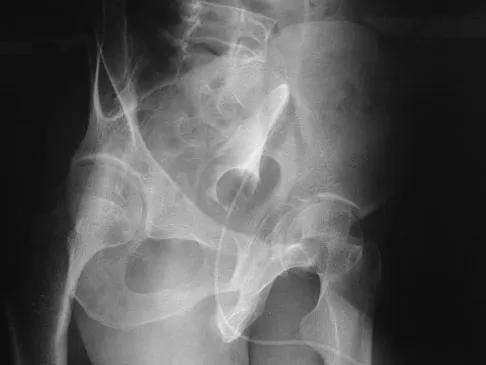 Trauma 2026 MCQs: Board Review Questions & Answers (Part 4) - Figure 57